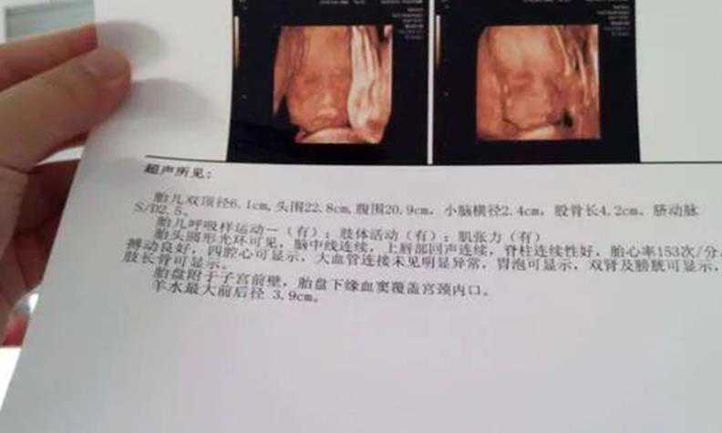 广州助孕收费 广州妇幼保健院试管成功率 ‘9个怀女孩征兆’